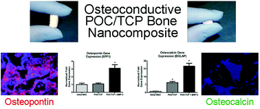 Graphical abstract: Advanced nanocomposites for bone regeneration