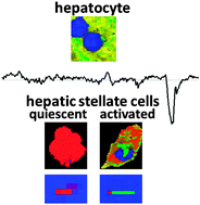 Graphical abstract: Exploitation of the hepatic stellate cell Raman signature for their detection in native tissue samples