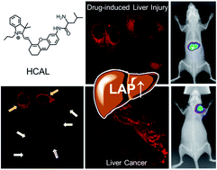Graphical abstract: In vivo imaging of leucine aminopeptidase activity in drug-induced liver injury and liver cancer via a near-infrared fluorescent probe