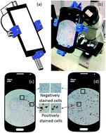 Graphical abstract: SmartIHC-Analyzer: smartphone assisted microscopic image analytics for automated Ki-67 quantification in breast cancer evaluation