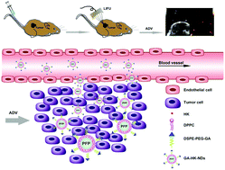 Graphical abstract: Preparation and evaluation of glycyrrhetinic acid-modified and honokiol-loaded acoustic nanodroplets for targeted tumor imaging and therapy with low-boiling-point phase-change perfluorocarbon