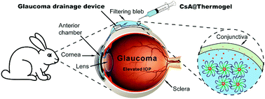 Graphical abstract: Sustained subconjunctival delivery of cyclosporine A using thermogelling polymers for glaucoma filtration surgery