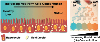 Graphical abstract: A microfluidic patterned model of non-alcoholic fatty liver disease: applications to disease progression and zonation