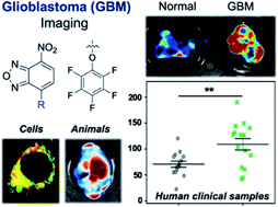 Graphical abstract: Penta-fluorophenol: a Smiles rearrangement-inspired cysteine-selective fluorescent probe for imaging of human glioblastoma