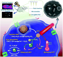 Graphical abstract: Transdermal delivery of multifunctional CaO2@Mn-PDA nanoformulations by microneedles for NIR-induced synergistic therapy against skin melanoma