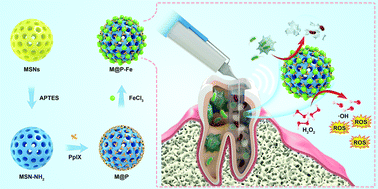 Graphical abstract: An MSN-based synergistic nanoplatform for root canal biofilm eradication via Fenton-enhanced sonodynamic therapy