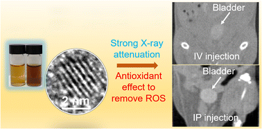 Graphical abstract: Ultrasmall cerium oxide nanoparticles as highly sensitive X-ray contrast agents and their antioxidant effect