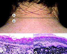 Graphical abstract: Photodamage of the skin