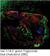 Graphical abstract: Lipid cartography of atherosclerotic plaque by cluster-TOF-SIMS imaging