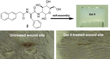 Graphical abstract: d-Glucosamine-based supramolecular hydrogels to improve wound healing