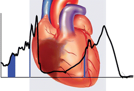 Graphical abstract: Potential of mid-infrared spectroscopy to aid the triage of patients with acute chest pain