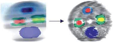 Graphical abstract: Reconstructive colour X-ray diffraction imaging – a novel TEDDI imaging method