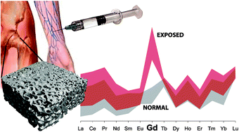 Graphical abstract: Incorporation of excess gadolinium into human bone from medical contrast agents