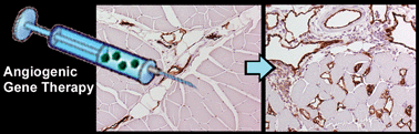 Graphical abstract: Stimulation of functional vessel growth by gene therapy