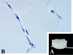 Graphical abstract: Dense fibrillar collagen matrices for tissue repair