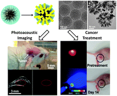 Graphical abstract: A novel multifunctional nano-platform with enhanced anti-cancer and photoacoustic imaging modalities using gold-nanorod-filled silica nanobeads