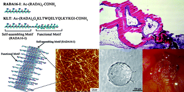 Graphical abstract: In vivo studies on angiogenic activity of two designer self-assembling peptide scaffold hydrogels in the chicken embryo chorioallantoic membrane