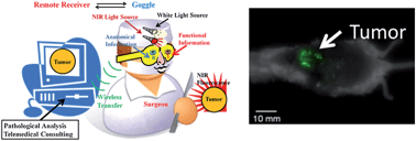 Graphical abstract: Intraoperative detection of liver tumors aided by a fluorescence goggle system and multimodal imaging