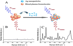 Graphical abstract: Blood plasma surface-enhanced Raman spectroscopy for non-invasive optical detection of cervical cancer