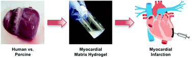 Graphical abstract: Human versus porcine tissue sourcing for an injectable myocardial matrix hydrogel