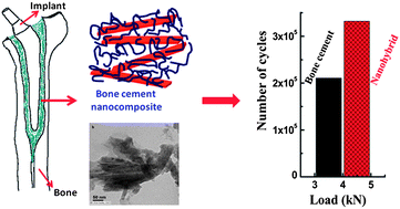Graphical abstract: Layered double hydroxide induced advancement in joint prosthesis using bone cement: the effect of metal substitution
