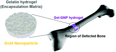 Graphical abstract: Enhanced bone regeneration with a gold nanoparticle–hydrogel complex