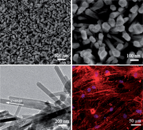 Graphical abstract: Magnetic hydroxyapatite coatings with oriented nanorod arrays: hydrothermal synthesis, structure and biocompatibility