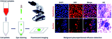 Graphical abstract: A rapid and convenient method for detecting a broad spectrum of malignant cells from malignant pleuroperitoneal effusion of patients using a multifunctional NIR heptamethine dye
