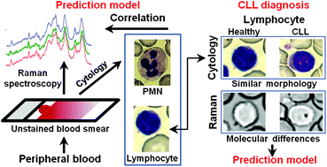 Graphical abstract: Diagnosis approach of chronic lymphocytic leukemia on unstained blood smears using Raman microspectroscopy and supervised classification