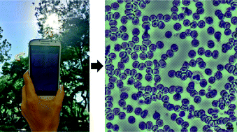Graphical abstract: A smartphone-based chip-scale microscope using ambient illumination