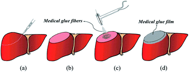 Graphical abstract: Airflow-directed in situ electrospinning of a medical glue of cyanoacrylate for rapid hemostasis in liver resection