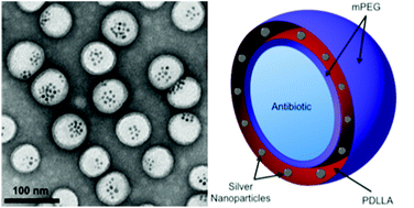 Graphical abstract: Silver nanoparticle-embedded polymersome nanocarriers for the treatment of antibiotic-resistant infections