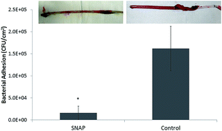 Graphical abstract: Reduction in thrombosis and bacterial adhesion with 7 day implantation of S-nitroso-N-acetylpenicillamine (SNAP)-doped Elast-eon E2As catheters in sheep