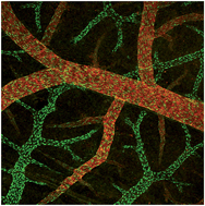 Graphical abstract: Angiogenic effects of ionic dissolution products released from a boron-doped 45S5 bioactive glass