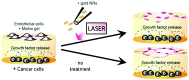 Graphical abstract: Nanoparticles for inhibition of in vitro tumour angiogenesis: synergistic actions of ligand function and laser irradiation