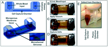 Graphical abstract: Mesoscale blood cell sedimentation for processing millilitre sample volumes