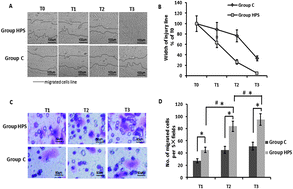 Graphical abstract: The involvement of aquaporin 1 in the hepatopulmonary syndrome rat serum-induced migration of pulmonary arterial smooth muscle cells via the p38-MAPK pathway