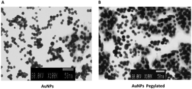 Graphical abstract: Inclusion bodies and pH lowering: as an effect of gold nanoparticles in Streptococcus pneumoniae