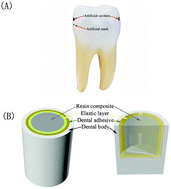Graphical abstract: New strategy for overcoming microleakage: an elastic layer for dental caries restoration