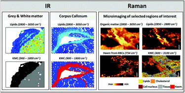 Graphical abstract: IR and Raman imaging of murine brains from control and ApoE/LDLR−/− mice with advanced atherosclerosis