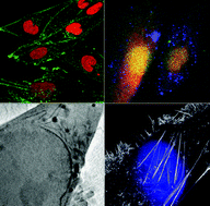 Graphical abstract: Structural and elemental changes in glioblastoma cells in situ: complementary imaging with high resolution visible light- and X-ray microscopy
