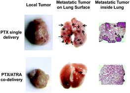 Graphical abstract: Co-delivery of all-trans-retinoic acid enhances the anti-metastasis effect of albumin-bound paclitaxel nanoparticles