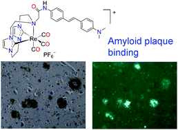 Graphical abstract: Rhenium(i) complexes of N-heterocyclic carbene ligands that bind to amyloid plaques of Alzheimer's disease