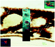 Graphical abstract: Iron accumulates in the primate choroid of the eye with aging as revealed with synchrotron X-ray fluorescence microscopy
