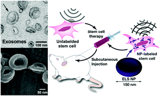 Graphical abstract: Exosome-like silica nanoparticles: a novel ultrasound contrast agent for stem cell imaging