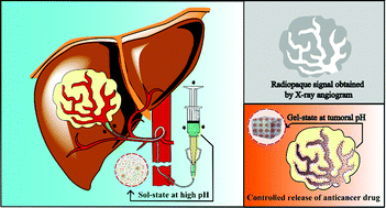 Graphical abstract: A novel sulfamethazine-based pH-sensitive copolymer for injectable radiopaque embolic hydrogels with potential application in hepatocellular carcinoma therapy