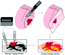 Graphical abstract: Raman spectroscopic analysis of the molecular composition of oral cavity squamous cell carcinoma and healthy tongue tissue