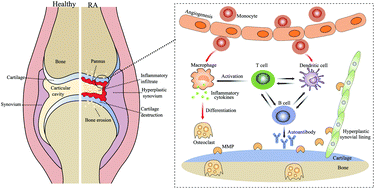 Graphical abstract: Recent advances in nanomedicines for the treatment of rheumatoid arthritis
