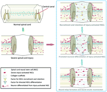 Graphical abstract: Bridging the gap with functional collagen scaffolds: tuning endogenous neural stem cells for severe spinal cord injury repair