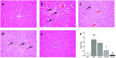 Graphical abstract: Effect of a novel potential probiotic Lactobacillus paracasei Jlus66 isolated from fermented milk on nonalcoholic fatty liver in rats